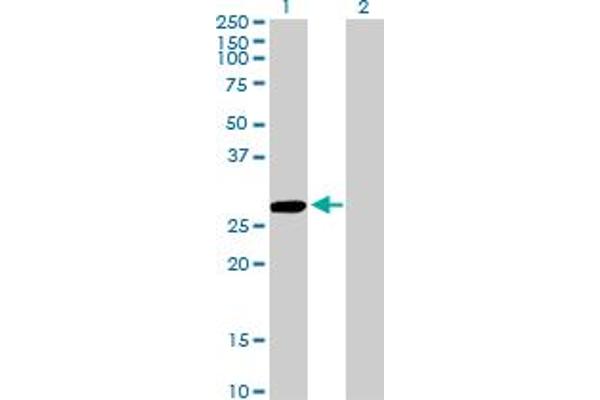 CCBL1 antibody  (AA 1-374)