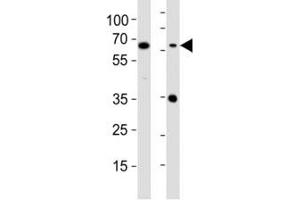 Western Blotting (WB) image for anti-CD63 (CD63) (AA 163-190) antibody (ABIN3030409)