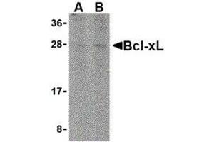 Western Blotting (WB) image for anti-BCL2-Like 1 (BCL2L1) (C-Term) antibody (ABIN2477605) (BCL2L1 antibody  (C-Term))