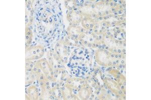 Immunohistochemistry of paraffin-embedded rat kidney using ENPEP antibody at dilution of 1:200 (40x lens). (ENPEP antibody)