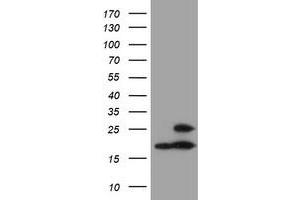 HEK293T cells were transfected with the pCMV6-ENTRY control (Left lane) or pCMV6-ENTRY PSMB9 (Right lane) cDNA for 48 hrs and lysed. (PSMB9 antibody  (AA 21-219))