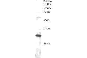 ABIN184710 staining (1µg/ml) of Jurkat lysate (RIPA buffer, 30µg total protein per lane). (DKK4 antibody  (C-Term))