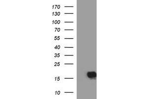 Image no. 1 for anti-SIVA1, Apoptosis-Inducing Factor (SIVA1) antibody (ABIN1500941)
