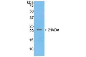Western blot analysis of recombinant Human FBN1. (Fibrillin 1 antibody  (AA 723-902))