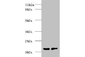 PSMB2 antibody  (AA 1-201)