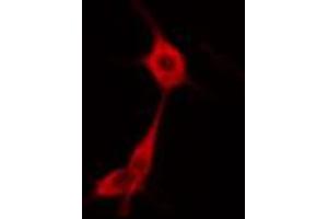ABIN6274669 staining HuvEc cells by IF/ICC. (GBP1 antibody  (C-Term))