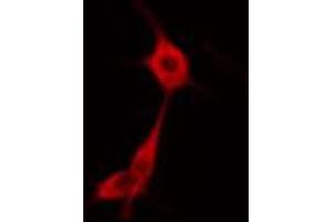 ABIN6274669 staining HuvEc cells by IF/ICC. (GBP1 antibody  (C-Term))