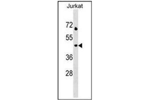 Western blot analysis using CD208 / LAMP3 Antibody (N-term) in Jurkat cell line lysates (35ug/lane). (LAMP3 antibody  (N-Term))