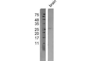 Mouse brain lysates probed with Anti-Persephin Polyclonal Antibody, Unconjugated  at 1:500 overnight at 4˚C. (Persephin antibody  (AA 51-156))