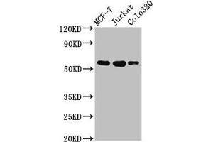 Western Blot Positive WB detected in: MCF-7 whole cell lysate, Jurkat whole cell lysate, Colo320 whole cell lysate All lanes: IRX4 antibody at 3 μg/mL Secondary Goat polyclonal to rabbit IgG at 1/50000 dilution Predicted band size: 55, 58 kDa Observed band size: 55 kDa (IRX4 antibody  (AA 287-363))