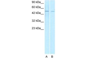 Western Blotting (WB) image for anti-ERG, ETS transcription factor (ERG) antibody (ABIN2463789) (ERG antibody)