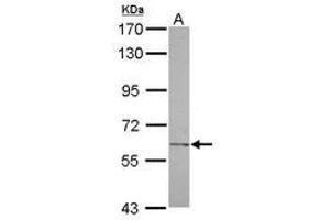 Image no. 1 for anti-Carbohydrate (N-Acetylglucosamine-6-O) Sulfotransferase 2 (CHST2) (AA 246-469) antibody (ABIN1497516) (CHST2 antibody  (AA 246-469))