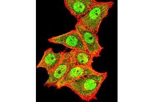Immunofluorescence analysis of Hela cells using TOP2A mouse mAb (green). (Topoisomerase II alpha antibody  (AA 1100-1530))