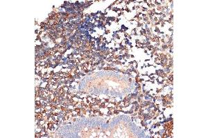 Immunohistochemistry of paraffin-embedded human appendix using EHD1 Rabbit mAb (ABIN7266911) at dilution of 1:100 (40x lens). (EHD1 antibody)