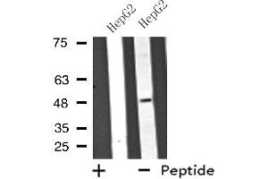 Western blot analysis of extracts from HepG2 cells using ATP6V1C2 antibody. (ATP6V1C2 antibody  (Internal Region))