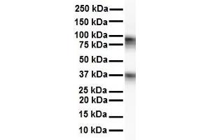 WB Suggested Anti-CPEB4 antibody Titration: 1 ug/mL Sample Type: Human Raji (CPEB4 antibody  (N-Term))