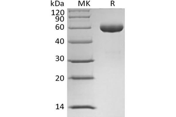 Angiopoietin 1 Protein (ANGPT1) (Fc Tag)