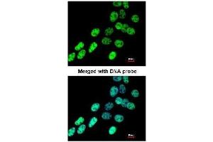 AP19043PU-N hnRNP-F antibody staining of Paraformaldehyde-fixed A431 by Immunofluorescence at 1/200 dilution. (HNRNPF antibody  (N-Term))