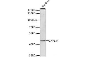 Western blot analysis of extracts of Rat liver using ZNF134 Polyclonal Antibody at dilution of 1:1000. (ZNF134 antibody)