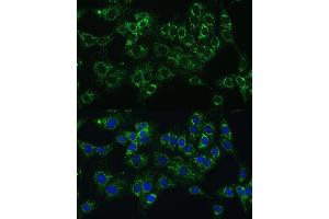 Immunofluorescence (IF) image for anti-Cytochrome B5 Type A (Microsomal) (CYB5A) (AA 1-100) antibody (ABIN6139296)