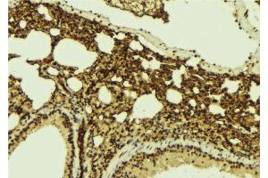 ABIN6267140 at 1/100 staining Mouse lung tissue by IHC-P.