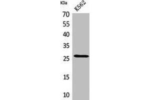 Western Blot analysis of K562 cells using FGF-8 Polyclonal Antibody. (FGF8 antibody  (Internal Region))
