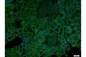 Paraformaldehyde-fixed, paraffin embedded Human kidney, Antigen retrieval by boiling in sodium citrate buffer (pH6. (CECR1 antibody  (AA 450-500))