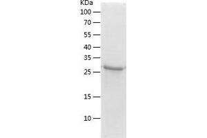 Western Blotting (WB) image for SGT1, Suppressor of G2 Allele of SKP1 (SUGT1) (AA 115-365) protein (His tag) (ABIN7289481) (SUGT1 Protein (AA 115-365) (His tag))