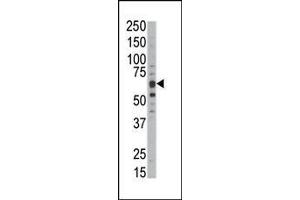 Western blot analysis of anti-DYRKB Pab in mouse kidney tissue lysate. (DYRK1B antibody  (C-Term))