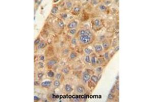 Immunohistochemistry (Paraffin-embedded Sections) (IHC (p)) image for anti-alpha-Methylacyl-CoA Racemase (AMACR) (AA 330-359), (C-Term) antibody (ABIN950388)