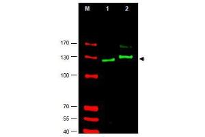 Image no. 1 for anti-GLI Family Zinc Finger 2 (GLI2) (AA 40-60), (AA 46-60), (Isoform alpha) antibody (ABIN401285) (GLI2 antibody  (Isoform alpha))
