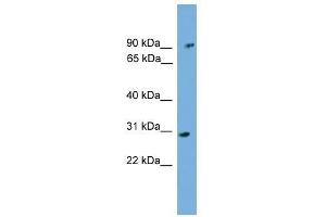 PHYH antibody used at 0. (PHYH antibody  (N-Term))