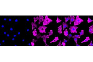 anti-Actin, alpha 1, Skeletal Muscle (ACTA1) antibody