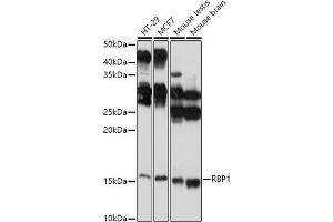 Western blot analysis of extracts of various cell lines, using RBP1 antibody (ABIN6129597, ABIN6146795, ABIN6146796 and ABIN6214136) at 1:1000 dilution. (RBP1 antibody  (AA 63-197))