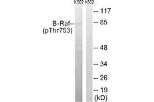 Western blot analysis of extracts from K562 cells treated with EGF 200ng/ml 30', using B-Raf (Phospho-Thr753) Antibody.
