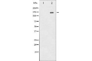 Western blot analysis of HER2 phosphorylation expression in HepG2 whole cell lysates,The lane on the left is treated with the antigen-specific peptide. (ErbB2/Her2 antibody  (pTyr1112))