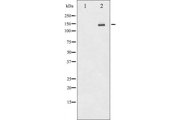 ErbB2/Her2 antibody  (pTyr1112)