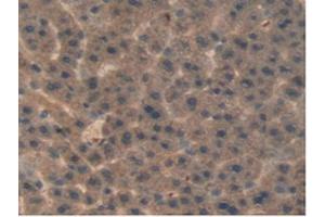 IHC-P analysis of Rat Liver Tissue, with DAB staining. (aHSP antibody  (AA 2-102))