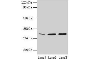 Western Blot All lanes: GTF2F2 antibody at 16 μg/mL Lane 1: Mouse spleen tissue Lane 2: K562 whole cell lysate Lane 3: A549 whole cell lysate Secondary Goat polyclonal to rabbit IgG at 1/10000 dilution Predicted band size: 29 kDa Observed band size: 29 kDa (GTF2F2 antibody  (AA 2-249))