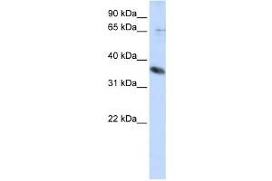 Western Blotting (WB) image for anti-ST6 (Alpha-N-Acetyl-Neuraminyl-2,3-beta-Galactosyl-1,3)-N-Acetylgalactosaminide alpha-2,6-Sialyltransferase 1 (ST6GALNAC1) antibody (ABIN2459116) (ST6GALNAC1 antibody)