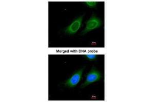 ICC/IF Image Immunofluorescence analysis of paraformaldehyde-fixed HeLa, using 15-PGDH, antibody at 1:200 dilution. (HPGD antibody  (C-Term))