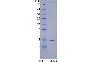 SDS-PAGE analysis of Human Spindlin 3 Protein. (SPIN3 Protein)