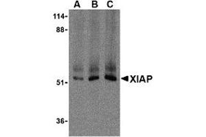 Western Blotting (WB) image for anti-X-Linked Inhibitor of Apoptosis (XIAP) (C-Term) antibody (ABIN1030806)