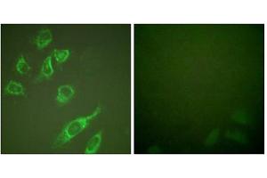 Immunofluorescence analysis of HeLa cells, treated with PMA (125ng/ml, 30mins), using 14-3-3 zeta (phospho-Ser58) antibody. (14-3-3 zeta antibody  (pSer58))