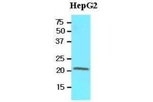 Cell lysates of HepG2 (60 ug) were resolved by SDS-PAGE, transferred to nitrocellulose membrane and probed with anti-human RBP4 (1:500).