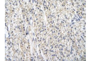 Rabbit Anti-PRMT2 Antibody       Paraffin Embedded Tissue:  Human cardiac cell   Cellular Data:  Epithelial cells of renal tubule  Antibody Concentration:   4.