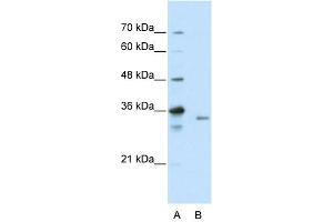 WB Suggested Anti-EXOSC3 Antibody Titration:  2. (EXOSC3 antibody  (C-Term))