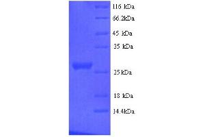 SDS-PAGE (SDS) image for Nidogen 1 (NID1) (AA 428-665) protein (His tag) (ABIN5713702) (Nidogen 1 Protein (NID1) (AA 428-665) (His tag))
