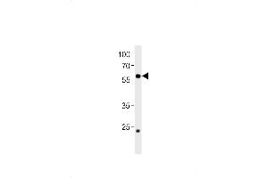 DANRE ccdc149b Antibody (N-term) Azb10009a western blot analysis in zebra fish heart tissue lysates (35 μg/lane). (CCDC149 antibody  (N-Term))