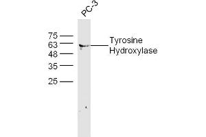 Human PC-3 lysates probed with Tyrosine Hydroxylase Polyclonal Antibody, unconjugated  at 1:300 overnight at 4°C followed by a conjugated secondary antibody at 1:10000 for 60 minutes at 37°C. (Tyrosine Hydroxylase antibody  (AA 101-165))